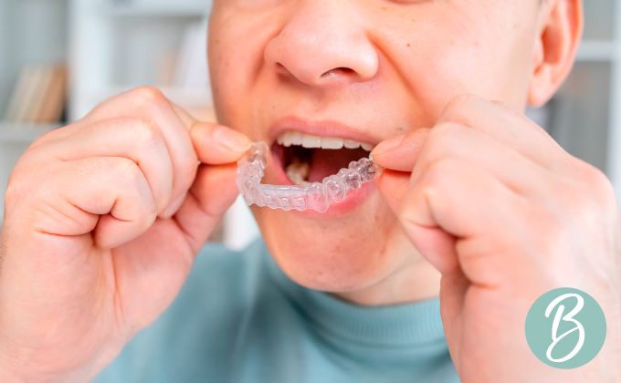 Lafayette Orthodontic treatments