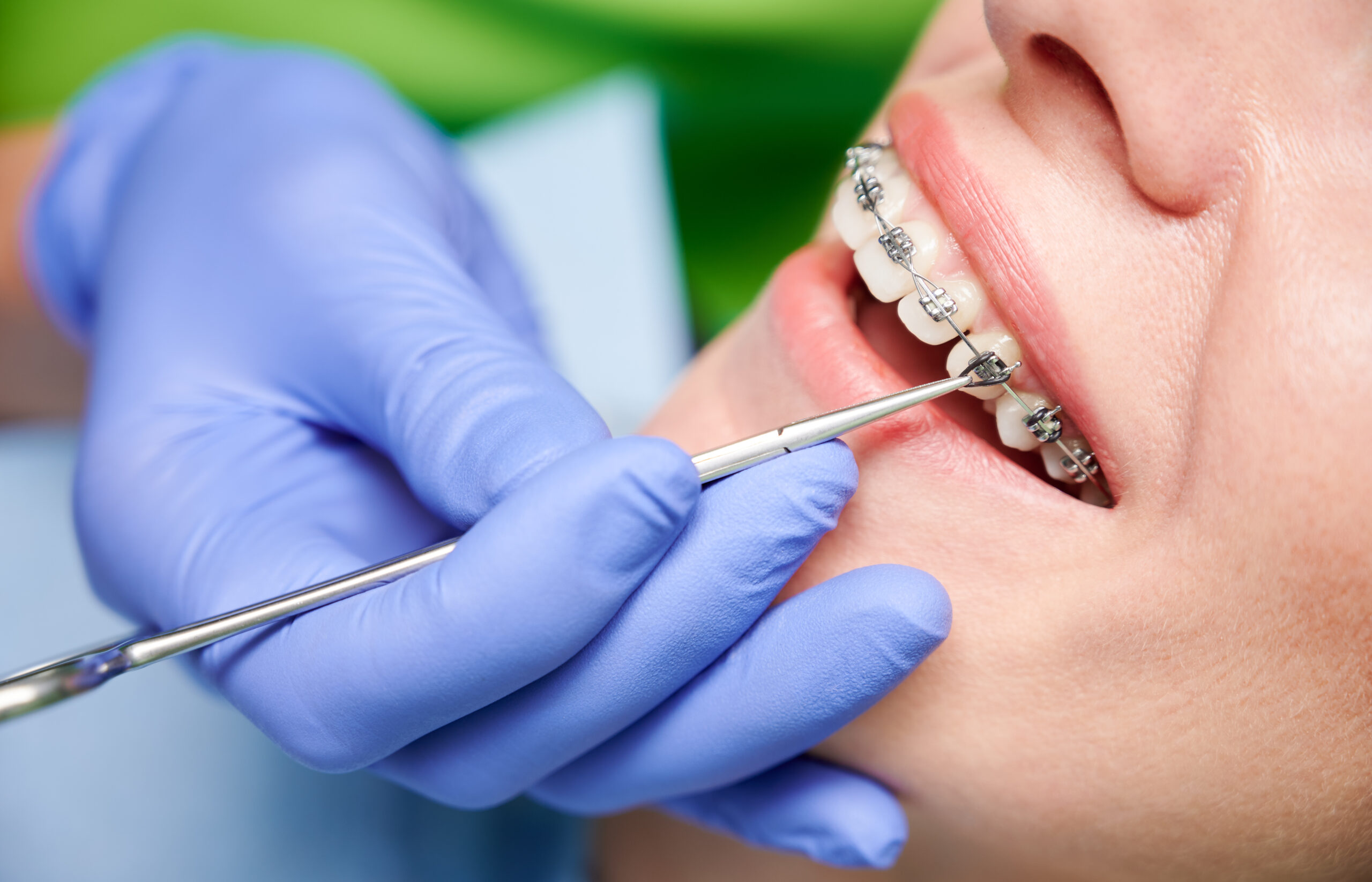 Lafayette orthodontist,