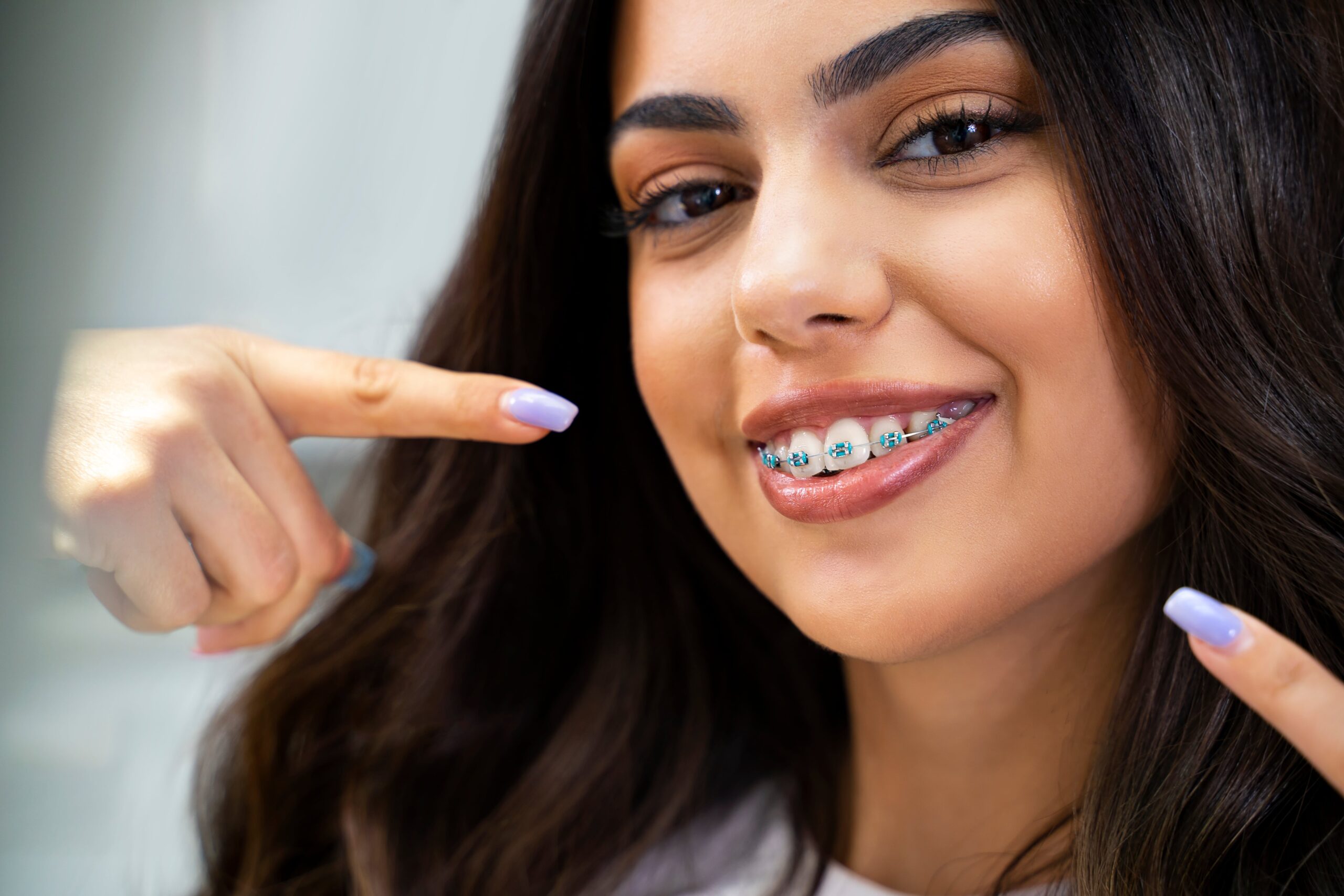 invisalign aligners near me